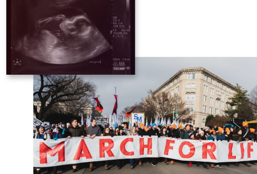 갓 잉태한 태아 사진과 \"생명을 위한 행진\" 집회 모습 (사진 출처 March of Life)